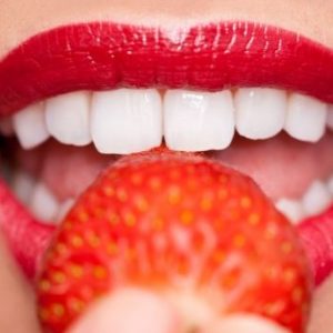 Blanqueamiento dental: Todo lo que debes saber